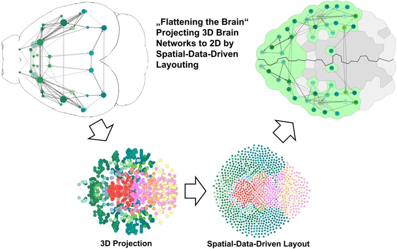 Visualization pipeline showing how 3D brain network data is analyzed.