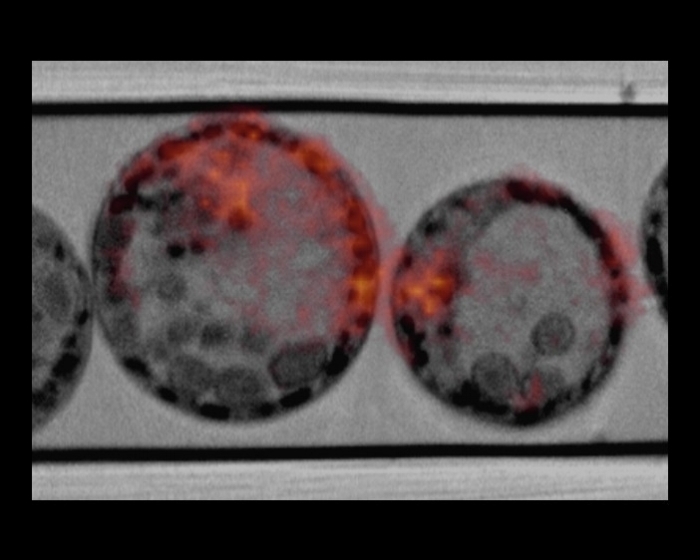 Screenshot, auf dem mehrere kreisförmige Elemente zu sehen sind. Diese stellen die Korrelation von Weichgewebe-Röntgentomographie und Cyro-Fluoreszenzmikroskopie für die Wissenschaft dar. 