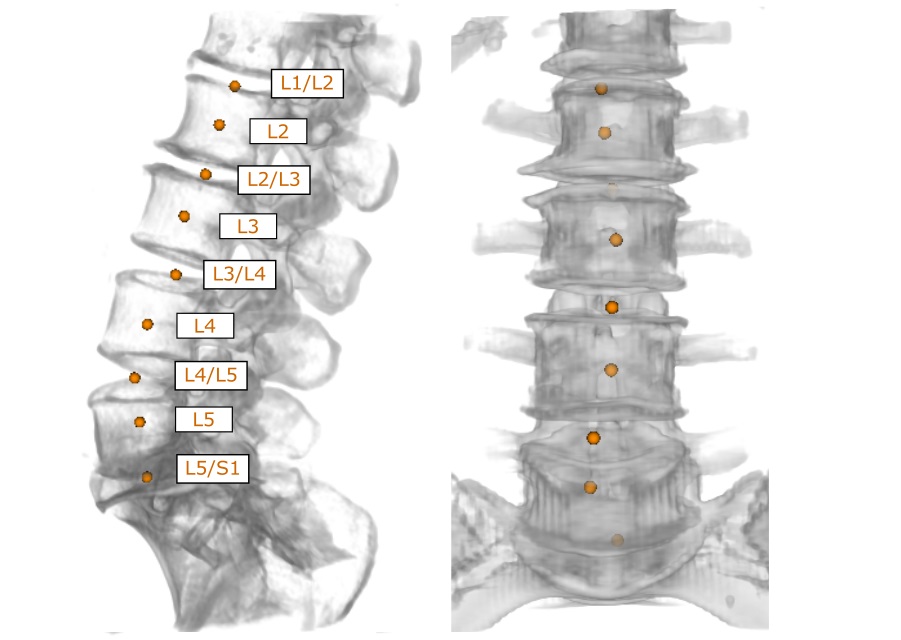 On a spinal column image, intervertebral discs and vertebrae are marked and annotated, all of which was conducted by a fully automated algorithm.