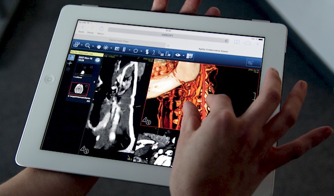 A tablet and a hand touching the screen on which a medical application for radiology is displayed.