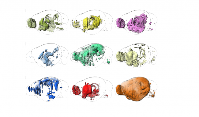 Beispielbilder für funktionelle Karten aus gewichteten Gehirnnetzwerken mit funktionellen genetischen Daten. 