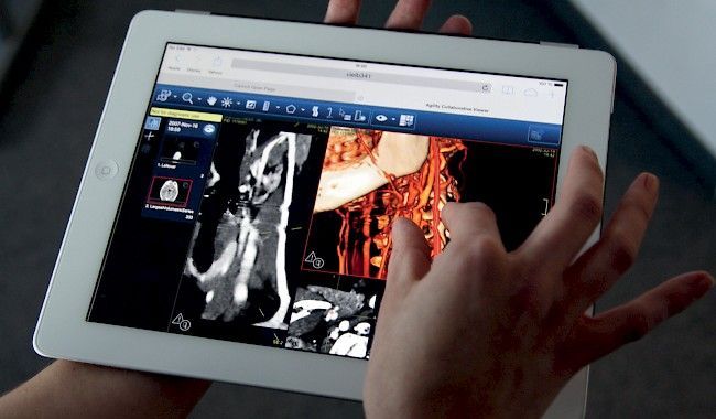 Ein Tablet sowie eine Hand die den Bildschirm berührt, auf welchem eine medizinische Anwendung für die Radiologie zu sehen ist.