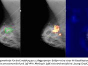 Drei Bilder nebeneinander, die jeweils die selbe radiologische Aufnahme einer weiblichen Brust mit einem Tumor zeigen. Links das Original, wo der Tumor von medizinischem Personal annotiert wurde. In der Mitte die Visualisierung der VRV-Lösung. Rechts die Visualisierung einer branchenüblichen Lösung. 